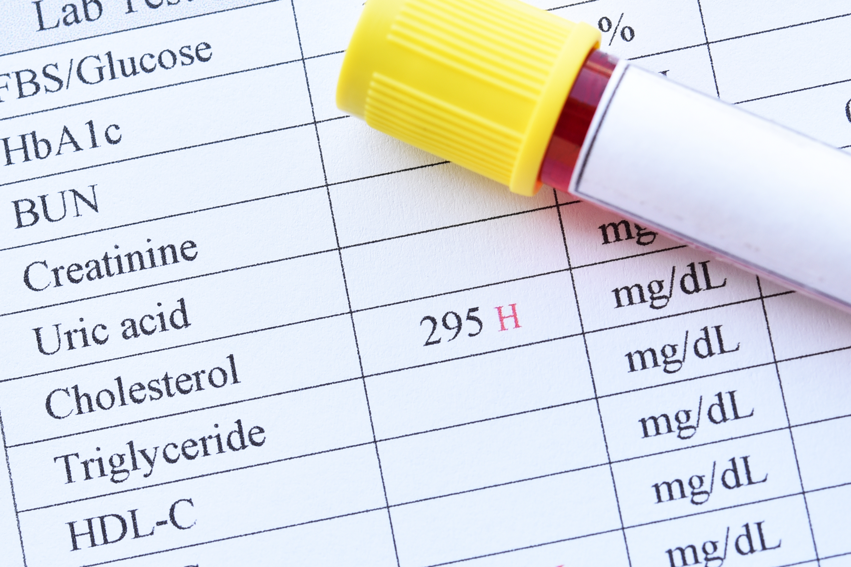 Тест на мочевую кислоту. Bilirubin Blood Test. Chol HDL direct что это.