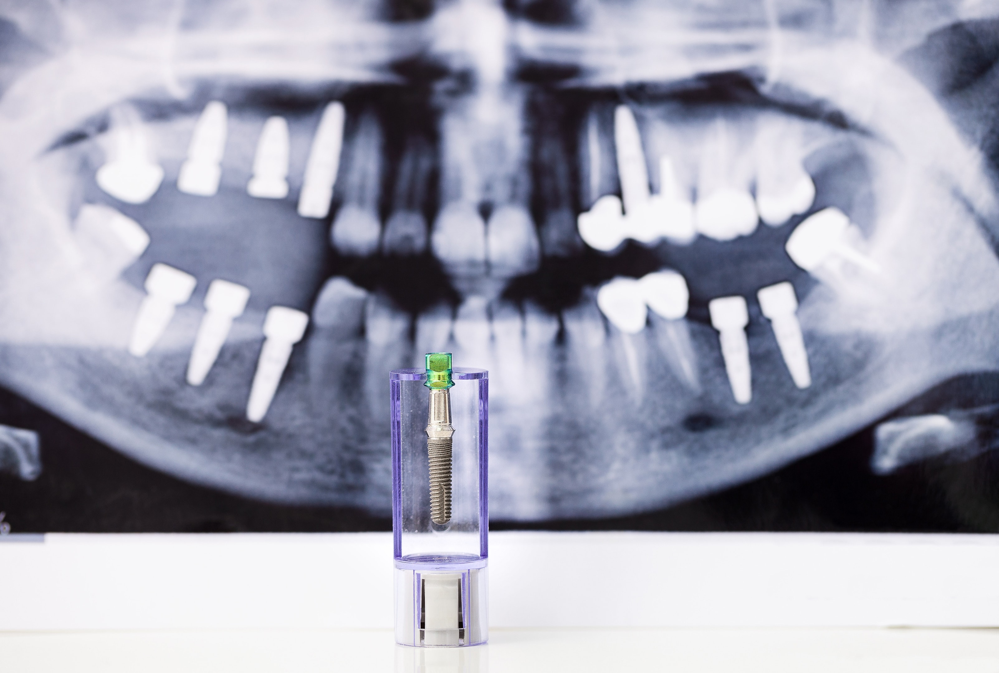 x-ray showing where there are healing abutments