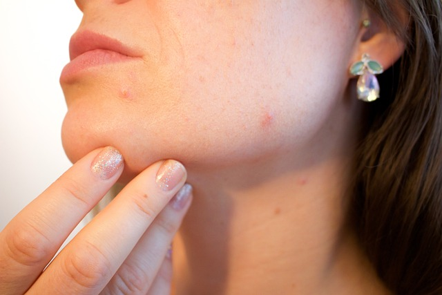 an image of a woman with a facial skin infection 