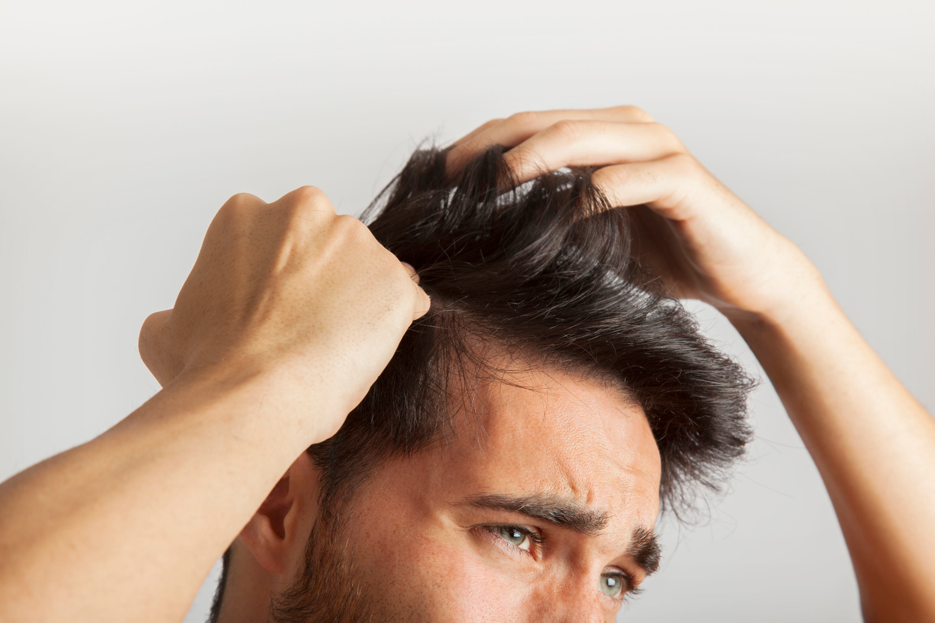 treating hair loss through medications Dutasteride vs Finasteride can treat male pattern baldness 