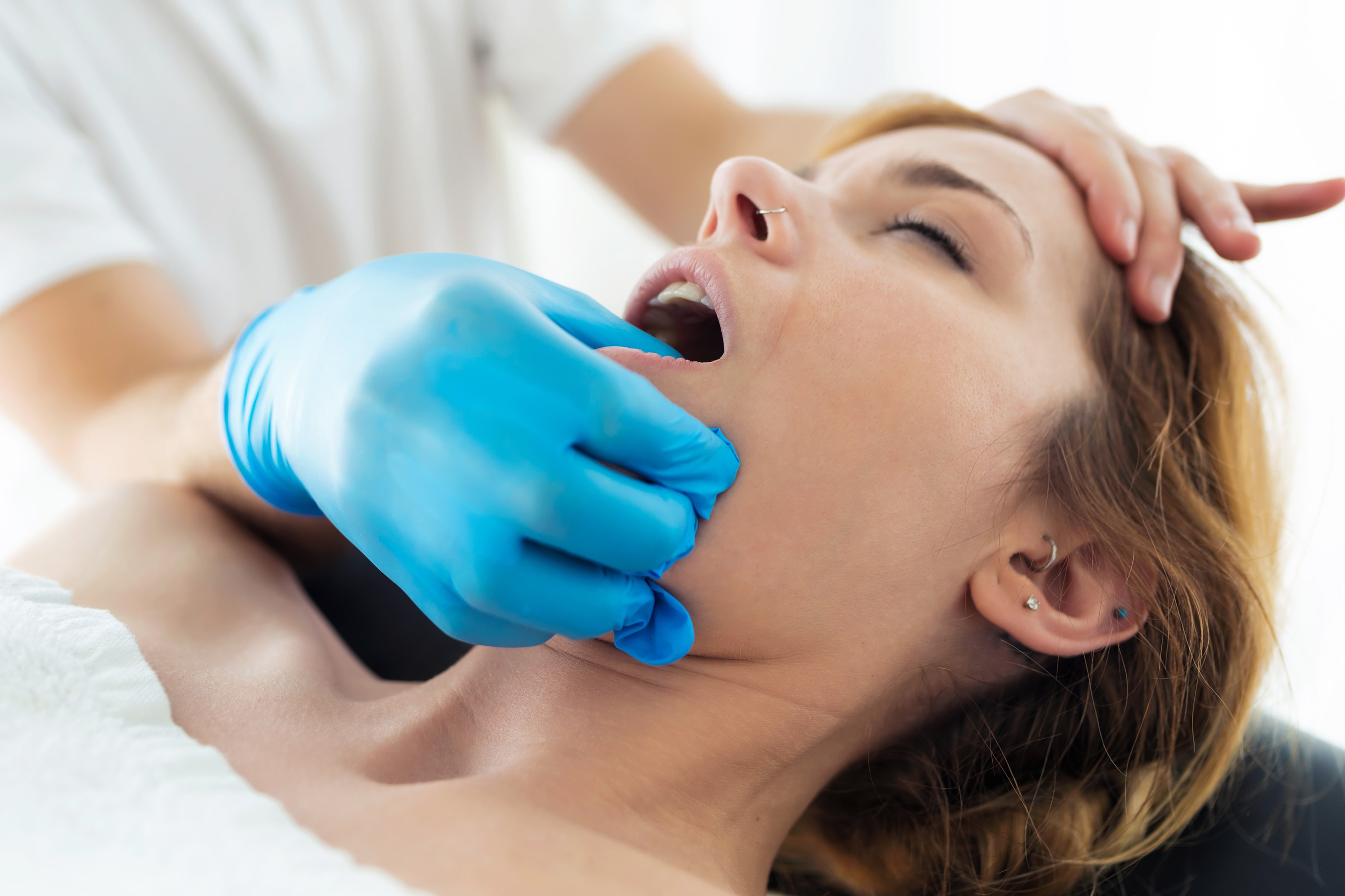 An image of a woman before maxillofacial surgery.