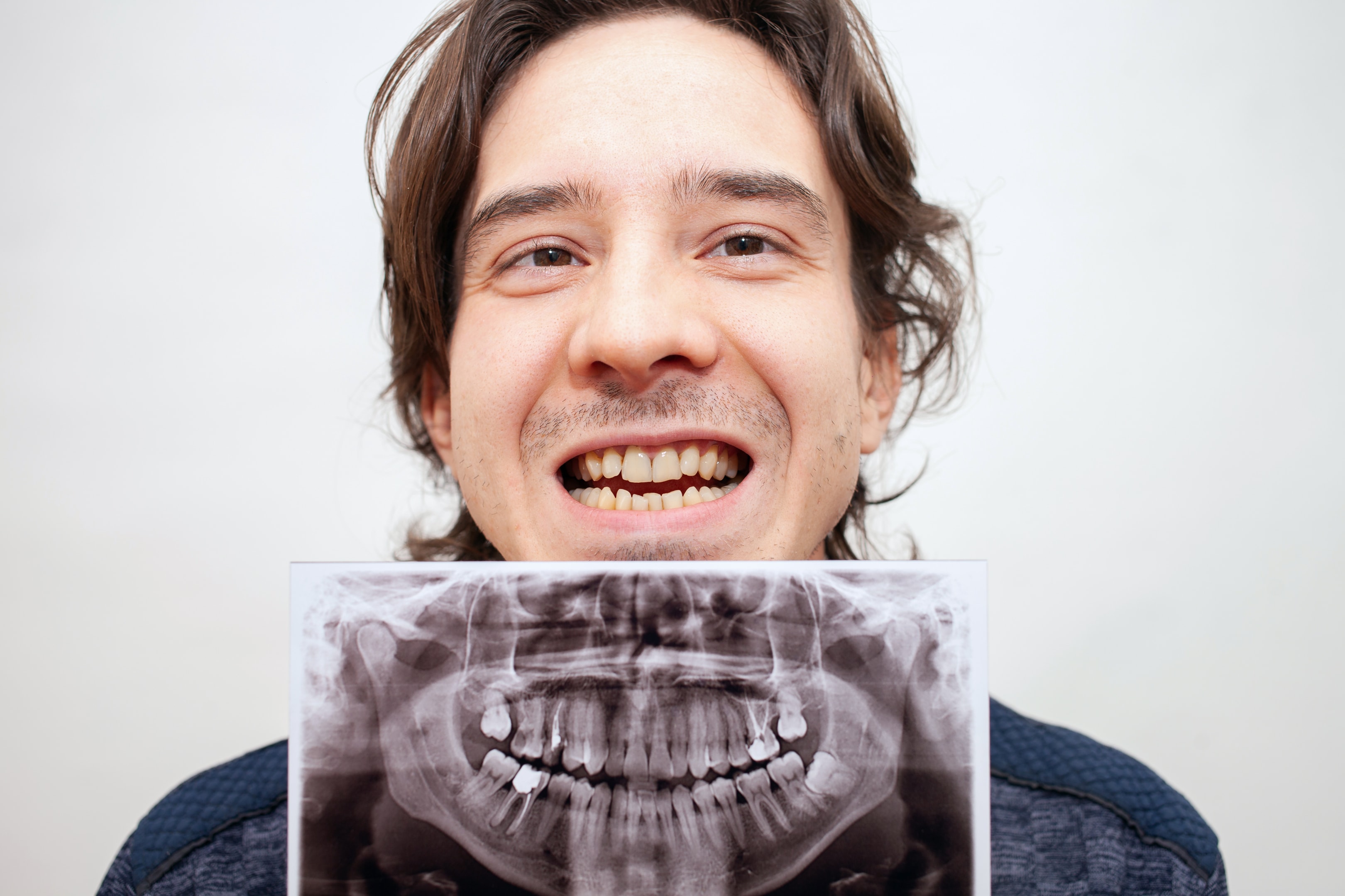 An image of a man checking his lower teeth