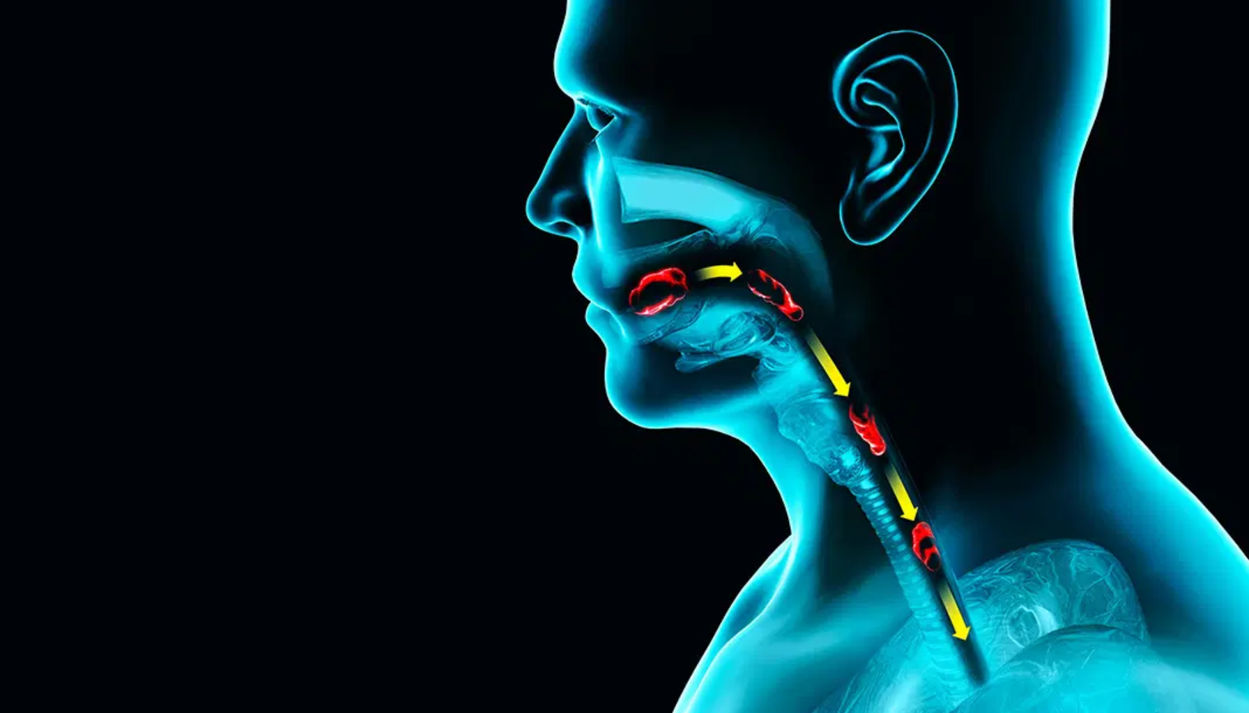 Medisinsk illustrasjon av menneskelig hals som viser luftveier, mandler og svelg med markeringspiler.