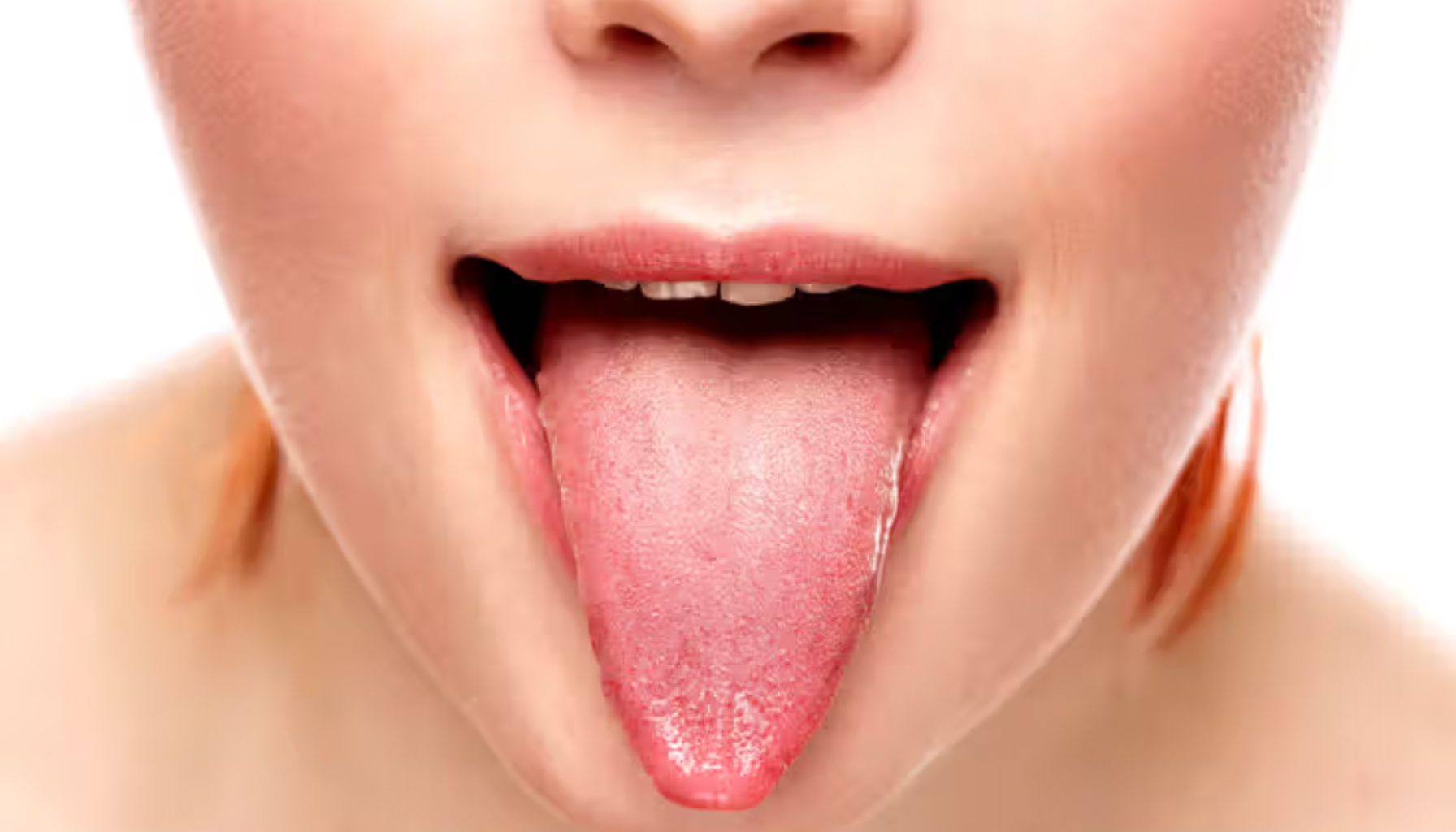 Nærbilde av munn med utstrakt tunge, viser normal, frisk overflate mot hvit bakgrunn.
