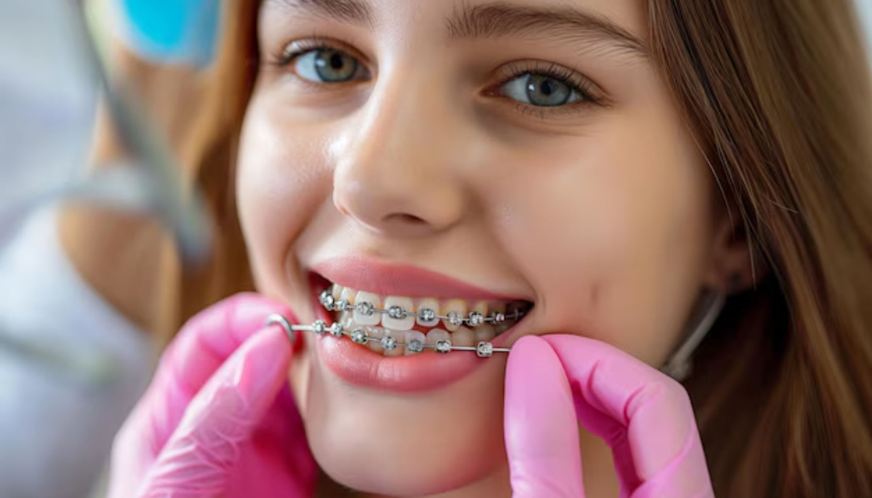 Tannlege med rosa hansker justerer tannregulering på ung jente med langt brunt hår som smiler i tannlegestolen. tannregulering alder tannregulering ta kontakt behandling barn tennene tenner helfo regulering får voksne barnet alder behandlingen tannlegen rett behov kjeveortoped spørsmål under store refusjon pasienten tillegg andre tannlege kjeveortopedi trenger avhengig gir underbitt kontakt hos fleste dersom første frem gjør derfor brukes tid lurer del varierer bruk informasjon 