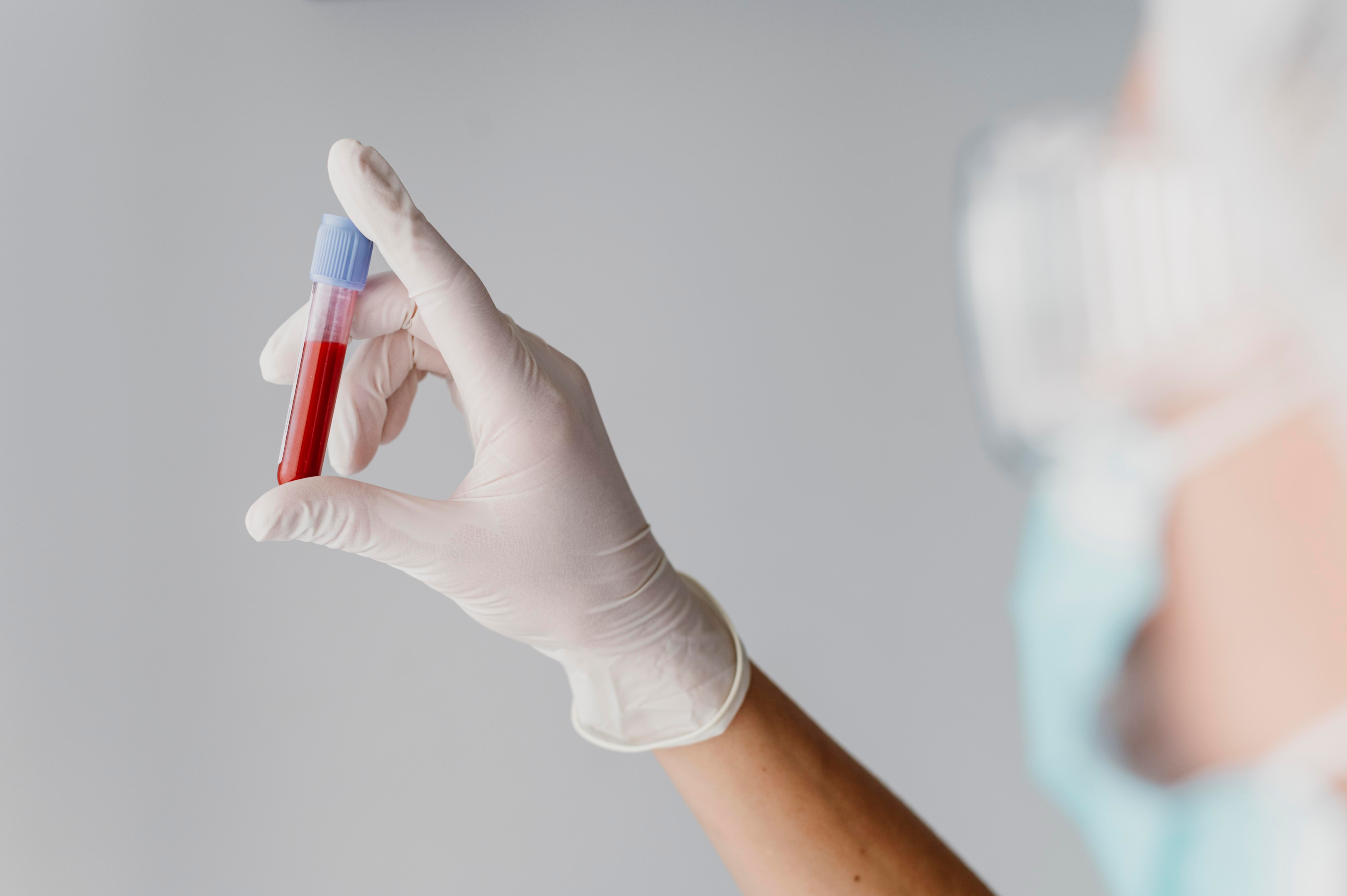 Most of the diagnostic tests use a blood sample.