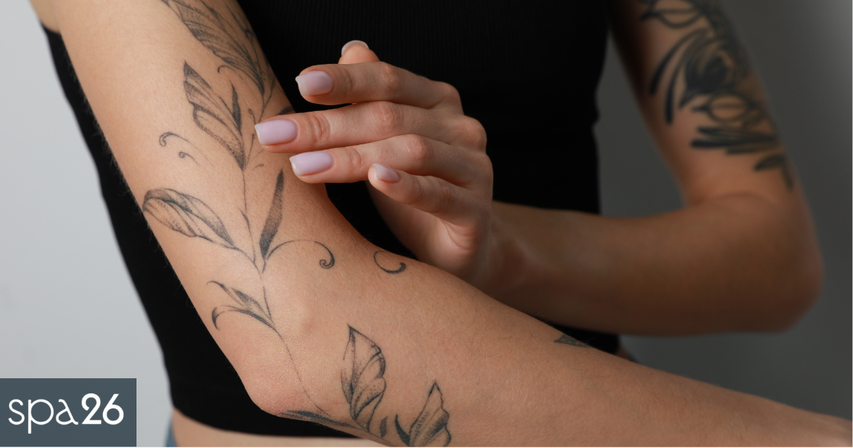 How to Care for Your Skin After Laser Tattoo Removal