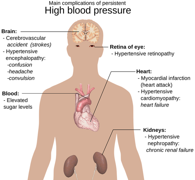 human body anatomy, overview, hypertension