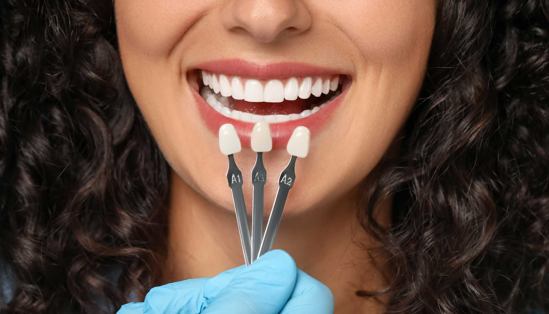 Kvinne med mørkt hår smiler mens tannlege sammenligner farger på tannfasetter foran munnen hennes.