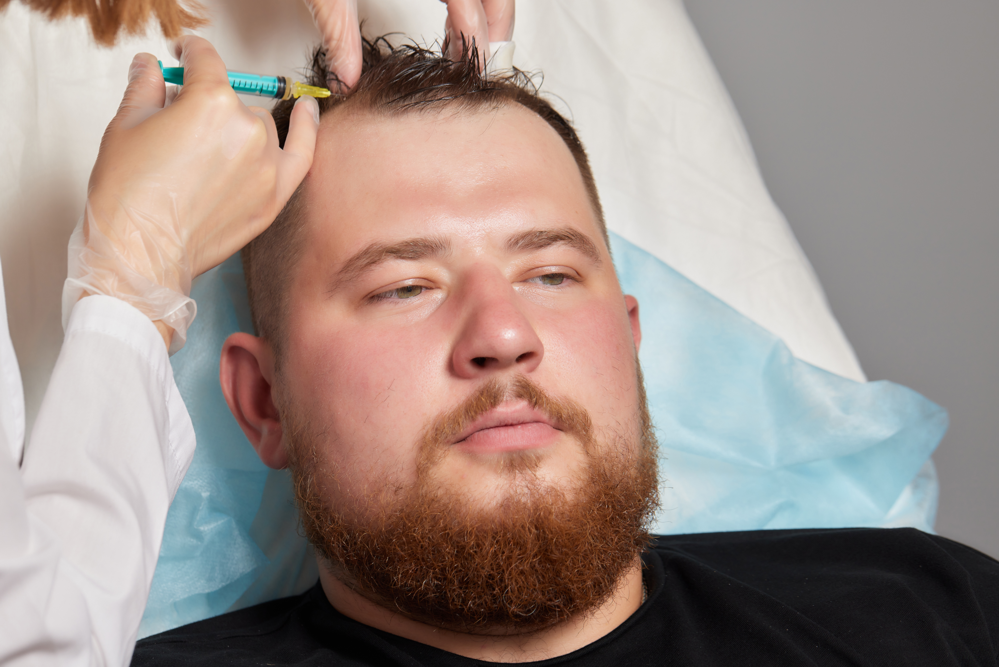 A man receiving a plasma injection in his scalp.