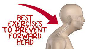 Forward Head Exercises to Fix Forward Head Posture - YouTube