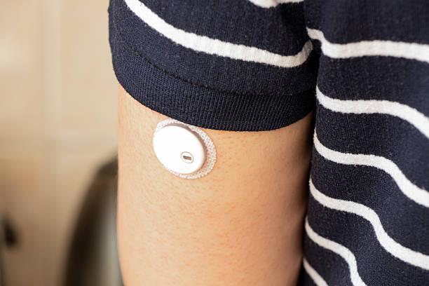 14-day CGM sensor | detecting glucose levels compared | forces glucose molecules | i clinical trial headed | traditional glucometer | tattoo sensor's accuracy | engineering researchers | electrical current | two electrodes | validate accuracy | injections | translational research institute | measures insulin levels | electrical and computer engineering