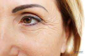 Are There Different Types Of Wrinkles? | Epiphany Dermatology
