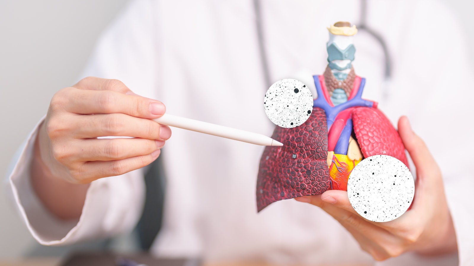 Dokter menjelaskan dampak partikel halus dari pembakaran sampah terhadap organ paru-paru.
