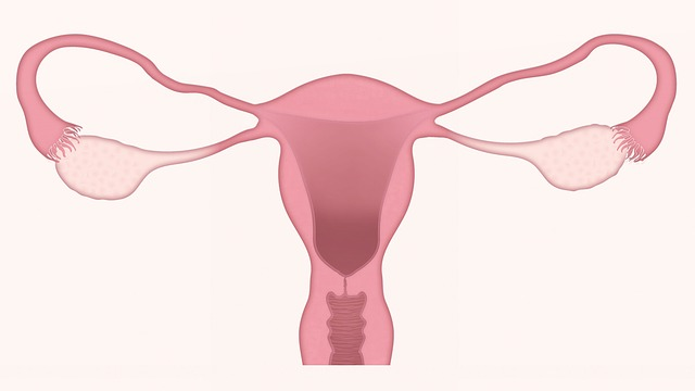 cervical cancer symptoms, gynecologic cancer, advanced cervical cancer