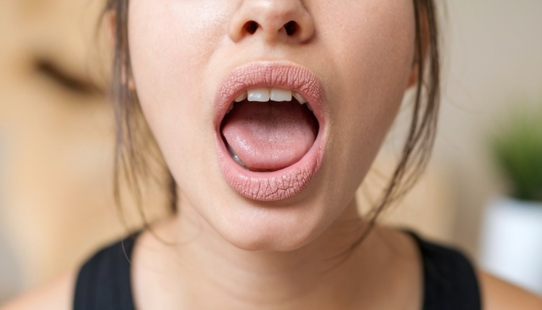 Munntørrhet tannlege refusjon: Hva har du rett på å få dekket 11 Nærbilde av person med åpen munn som viser tunge og tørre lepper i naturlig innemiljø rundt ansiktet. munntørrhet tannlege refusjon hull i tennene stønad til tannbehandling nedsatt evne til egenomsorg patologisk tap av tannsubstans helt eller delvis tanntap delvis tanntap uten egne tanntap uten egne tenner evne til egenomsorg hos svulster i munnhulen tilgrensende egne tenner i underkjeven allergiske reaksjoner mot tannrestaureringsmaterialer direkte oppgjør med helfo varig nedsatt funksjonsevne sterkt nedsatt evne særlige medisinske tilstander sjelden medisinsk tilstand egenomsorg hos personer munnhulen tilgrensende vev direkte oppgjør medisinske tilstander hos tannlegen få dekket personer som har varig rett til stønad munn og kjeve økt kariesaktivitet sykdommer og anomalier anomalier i munn gi rett tannskade ved ulykke hoderegionen for øvrig munntørrhet dårlig ånde godkjent yrkesskade få stønad helfo refusjon tannbehandling tannlegen helfo behandling hos tannlege stønad refusjon tennene munnen rett utgifter hull tannlege viktig gir hyposalivasjon spytt mer dekning krav dekket får støtte tørr økt munn behandlingen derfor betale godkjent karies munntørrheten kariesaktivitet dersom råd tilfeller yrkesskade eldre gis finner årsaken dekkes andre medisiner