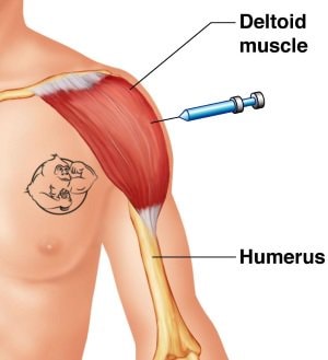 testosterone propionate injection site