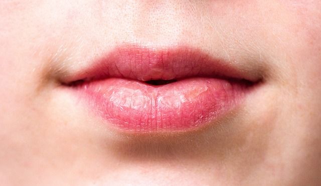 A close up image of a woman's dry lips due to ignoring menopause and throat health. 