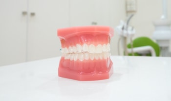 dental implant 