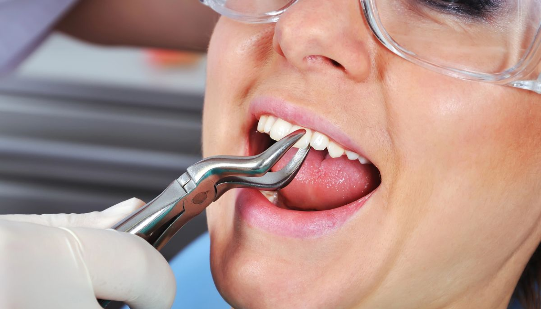 Fjerne veke etter visdomstann: Når og hvordan det gjøres trygt 7 Tannlege bruker tang for å trekke tann mens pasienten ligger i stol med beskyttelsesbriller.