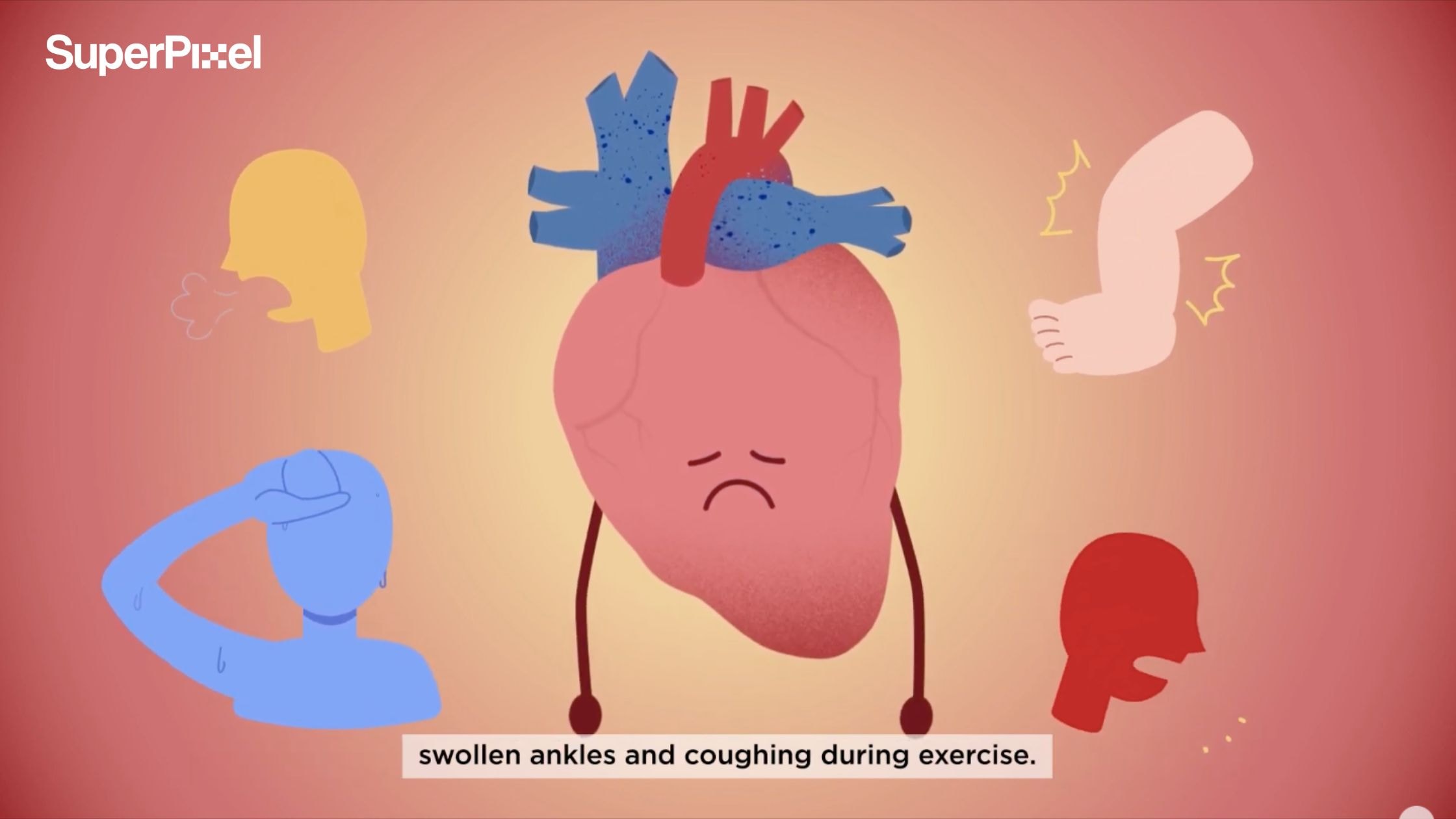 Novartis Heart Failure Education Video by Superpixel