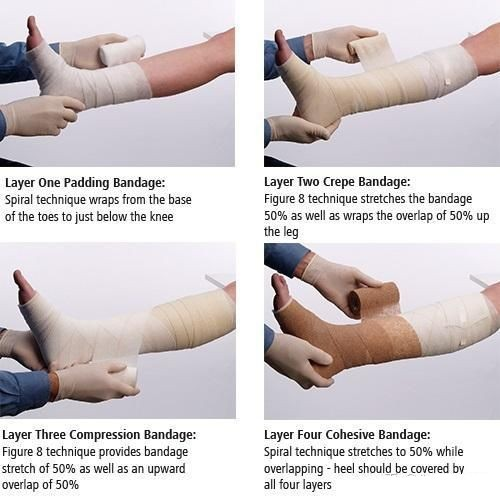 How to properly apply bandage compression therapy? - BKA MED