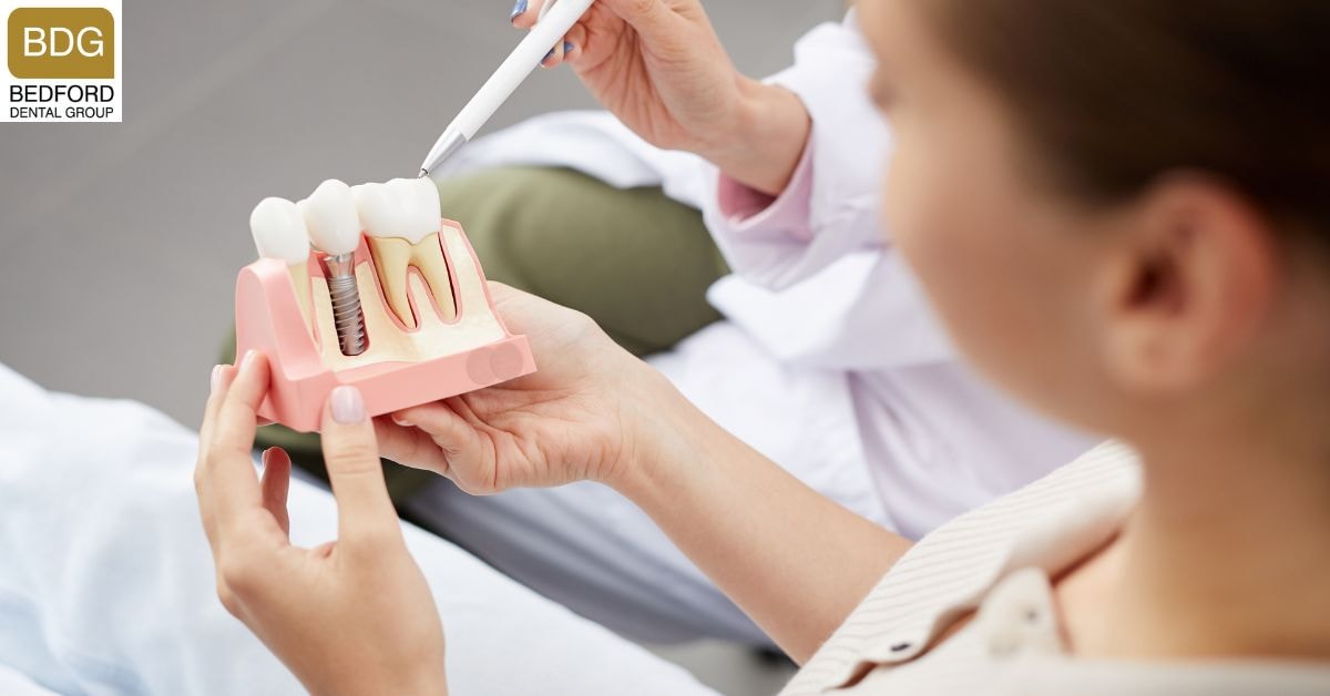 What are Dental Implants?