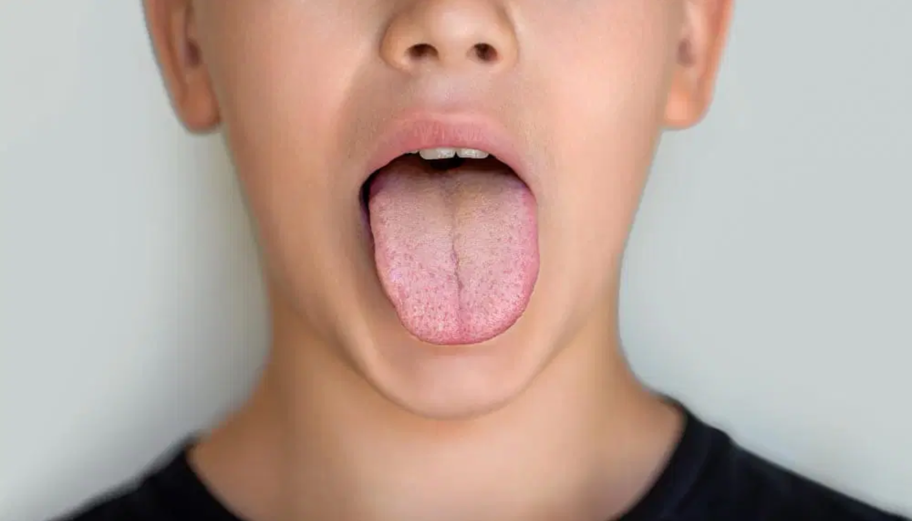 Barn viser tungen med åpen munn mot nøytral bakgrunn, fokus på tunge og munnhule.