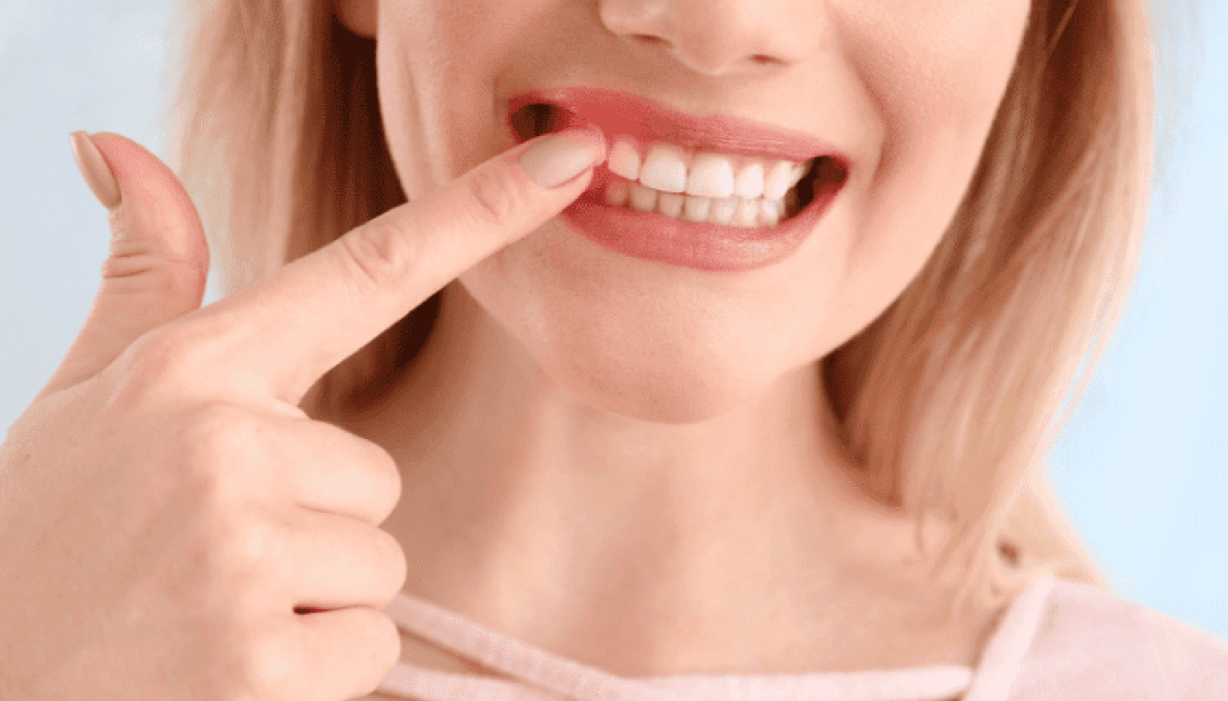 Kvinne peker på rødt og irritert tannkjøtt foran speil som viser tidlige tegn på betennelse. betennelse tannkjøtt munnskyll tennene tannkjøttbetennelse og andre andre infeksjoner i munnhulen bakteriebelegg på tennene tannkjøttbetennelse tannkjøttbetennelse og andre infeksjoner etablert betennelse i tannkjøtt 2 mg ml infeksjoner i munnhulen tannkjøtt og munnslimhinne samt opprettholde god munnhygiene ml munnskyllevæske god munnhygiene på annen annen måte er nedsatt munnhygiene på annen måte unngå å svelge corsodyl corsodyl brukes betennelse i tannkjøttet typer sopp og virker sopp og virker desinfiserende dreper bakterier og visse 300 ml barn under 12 år forebygge bakteriebelegg på tennene brukes dessuten ved etablert dessuten ved etablert betennelse mulighetene for å opprettholde 2 mg munnslimhinne samt trøske peppermyntesmak renset vann glyserol makrogolglyserolhydroksystearat sorbitol corsodyl brukes dessuten reseptfritt legemiddel brukes for å forebygge nedsatt eller når spyttsekresjonen spyttsekresjonen er nedsatt spytt ut overflødig 2 ganger daglig corsodyl morgen og kveld