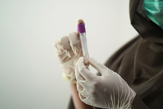 blood test, providing qualified trained phlebotomists, only professional procedures