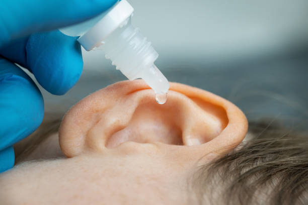 A person pouring hydrogen peroxide solution into their ear canal