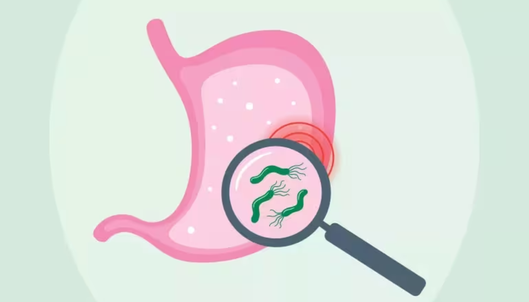 Illustrasjon av mage med forstørrelsesglass som viser bakterien Helicobacter pylori, knyttet til magesår og mageinfeksjoner.