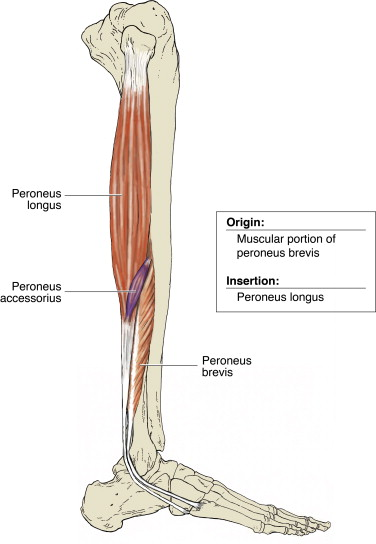 Depiction of the peroneal muscle group displaying their origin and insertion.