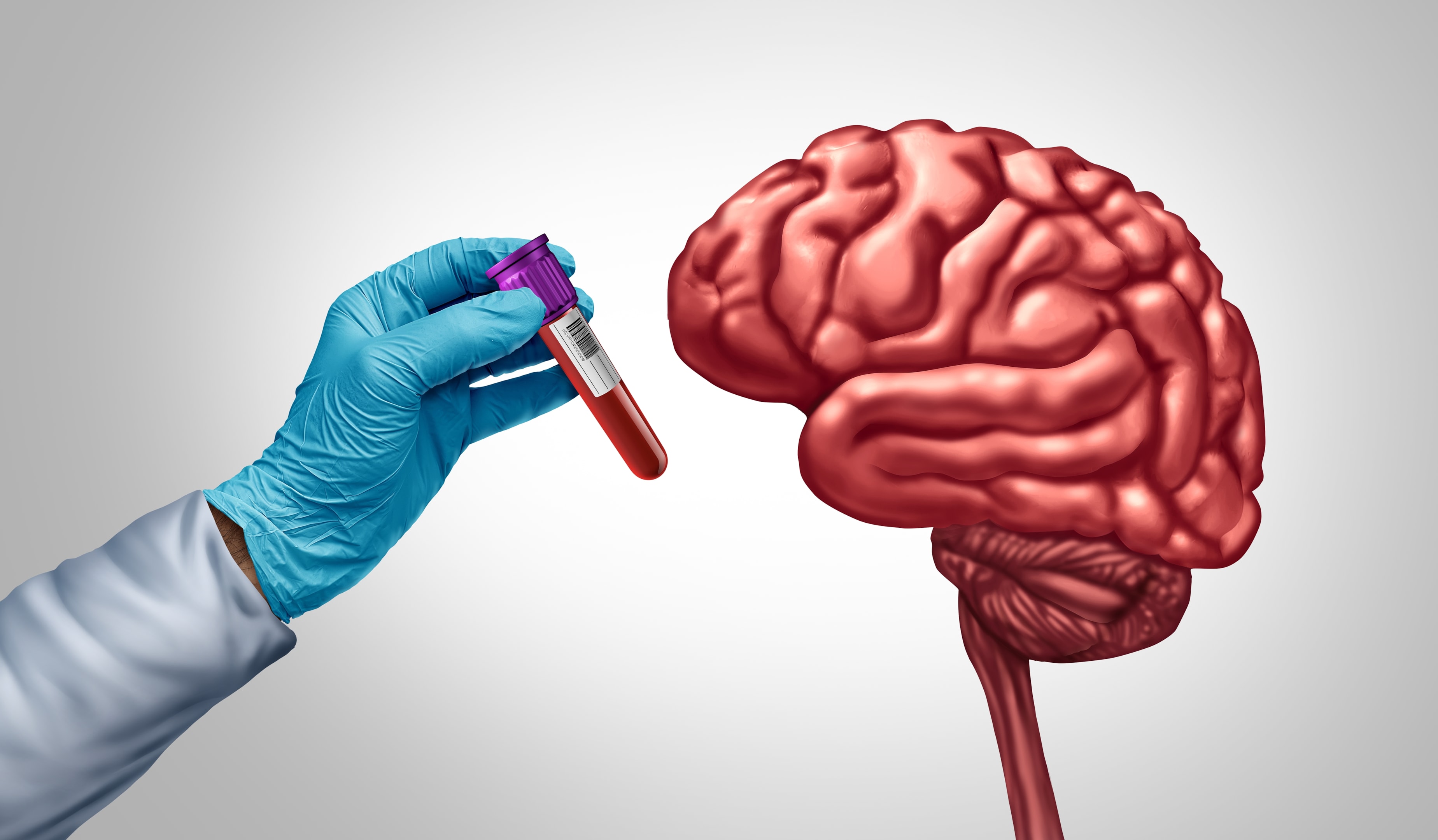 Blood tests are being trialed to detect dementia.