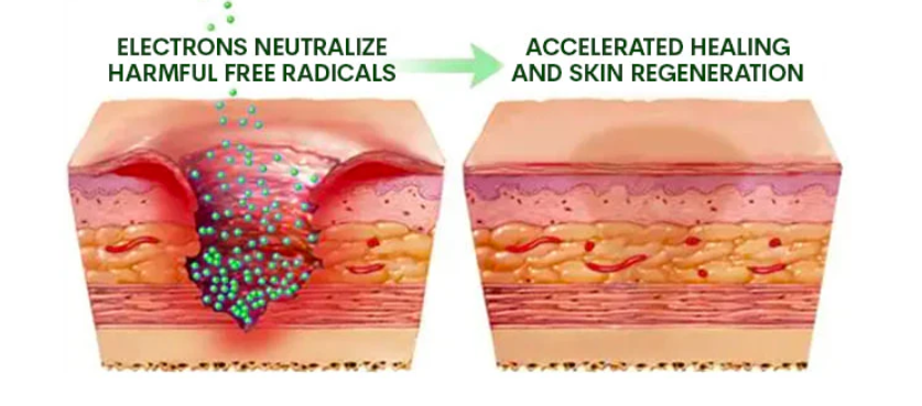 Grounding promotes wound healing