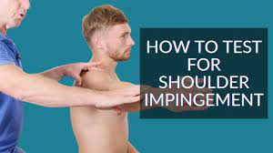 How to test for Shoulder Impingement? - YouTube