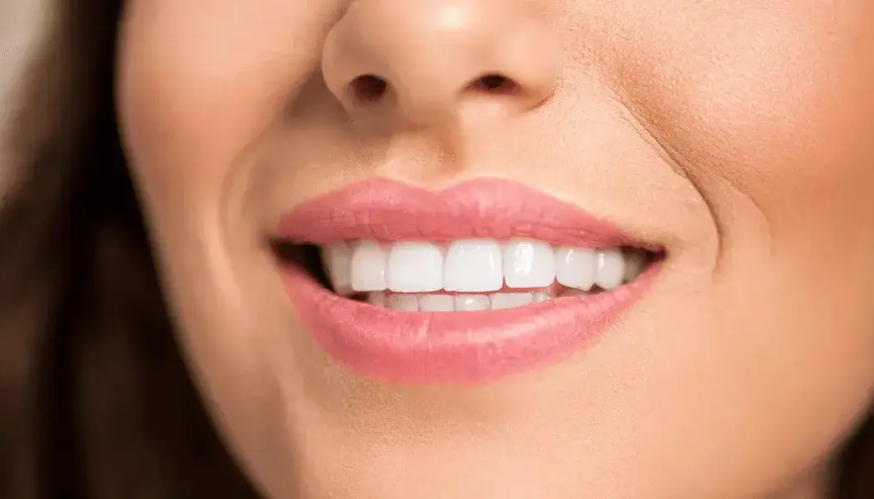 Nærbilde av kvinne som smiler og viser rette, hvite tenner med glansfulle lepper og jevn hudtone.