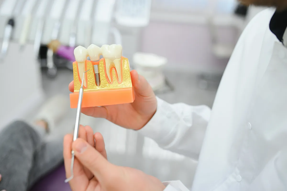 Dental professional holding educational tooth implant model during explanation.