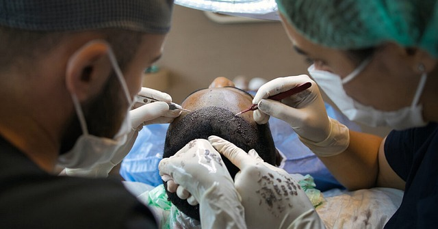 hair transplant surgery male patients