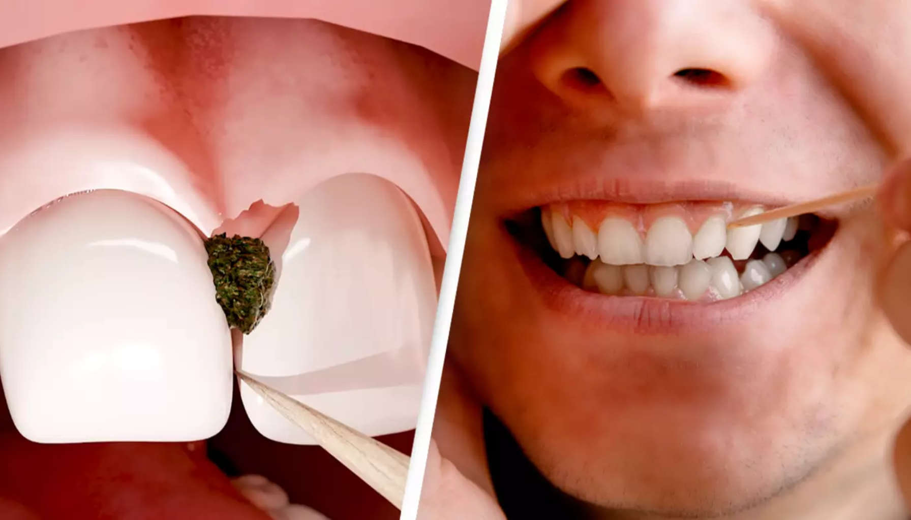 Nærbilde av matrester mellom tenner og en person som bruker tannpirker for å rense tennene med et smil.