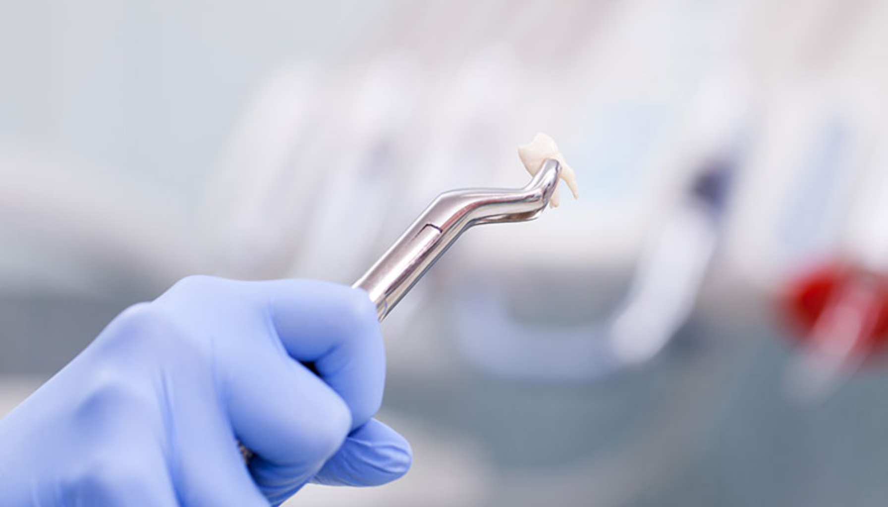 Trekke tann pris – Dette må du vite før behandling 12 Tannlege med blå hanske holder en nylig trukket tann med tang foran uskarp bakgrunn i klinikkmiljø.