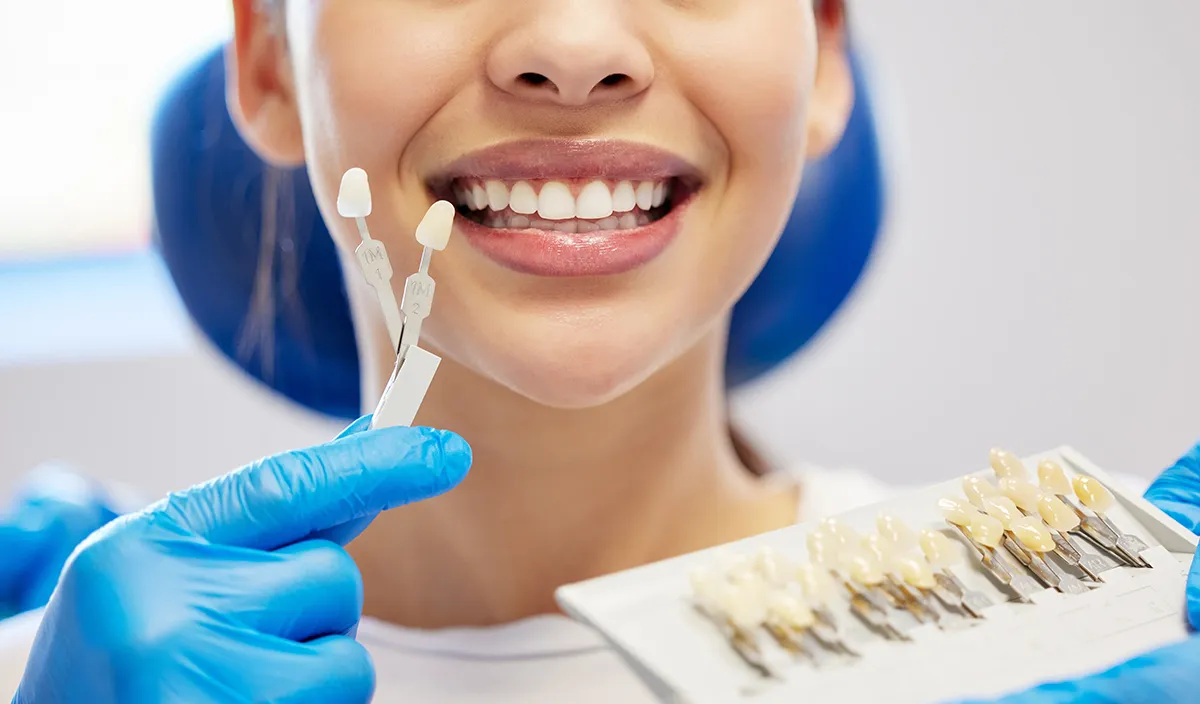 A dental professional matching tooth shades with a patient