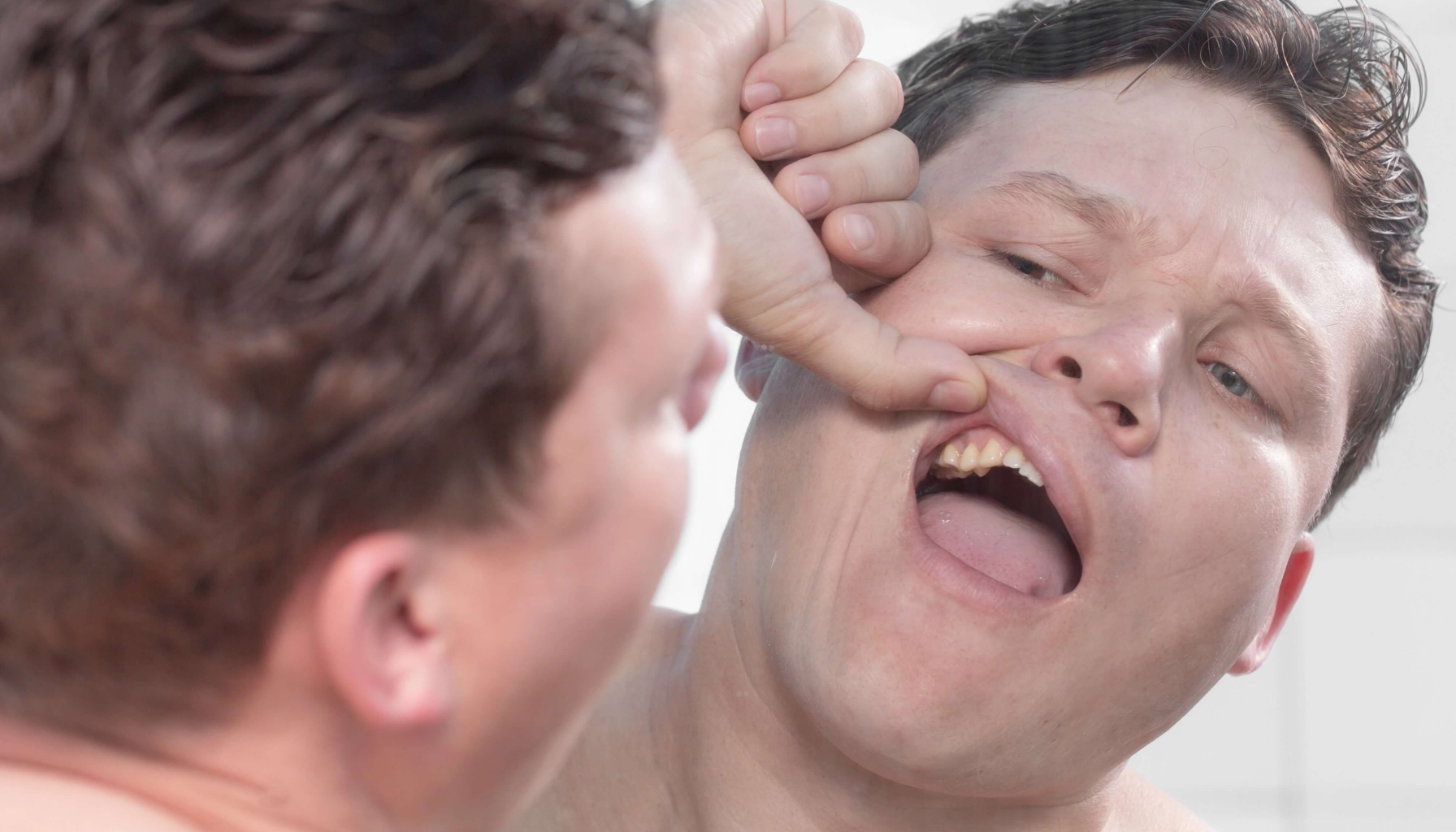 Løs Tann i Voksen Alder: Når Det Er Et Varseltegn 13 Person undersøker munn i speil, trekker leppen opp for å vise tenner og tannkjøtt hjemme med hånden nøye.