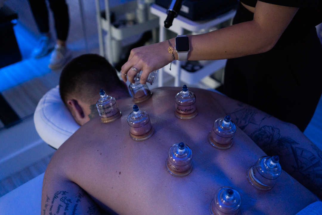 cupping therapy massage