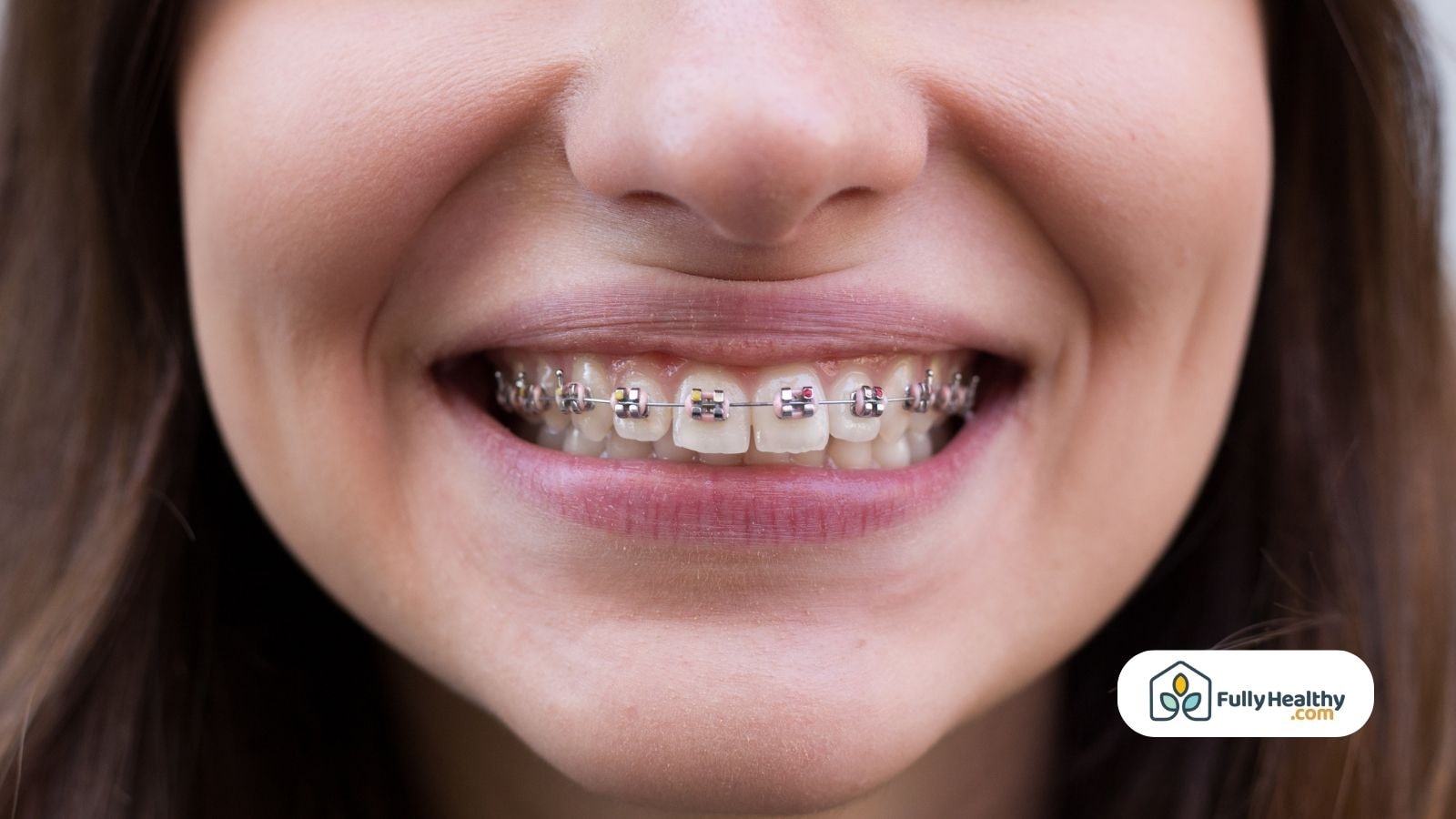 Close-up of smiling girl wearing metal dental braces
