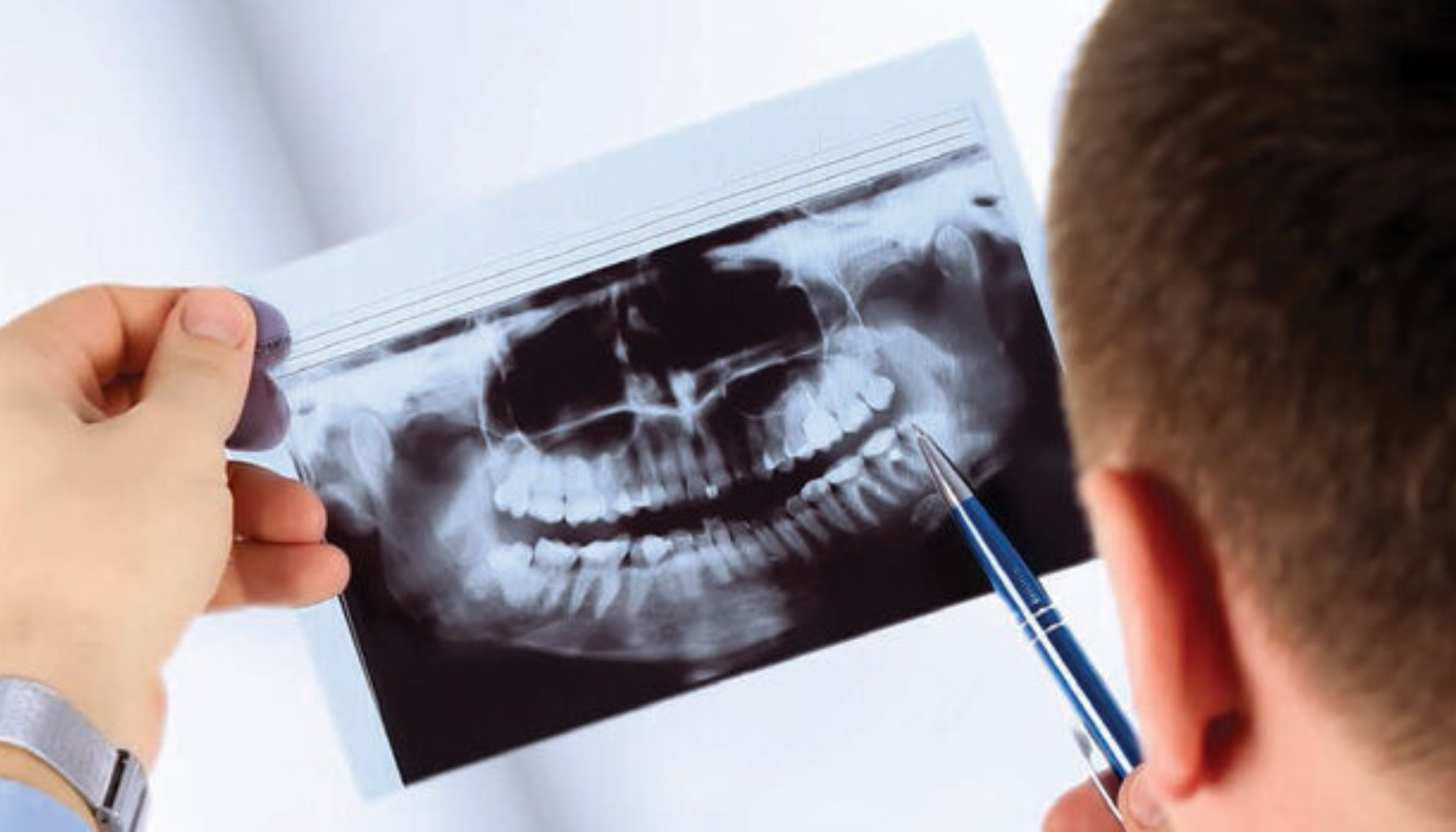 Tannresorpsjon – når tannens struktur brytes ned