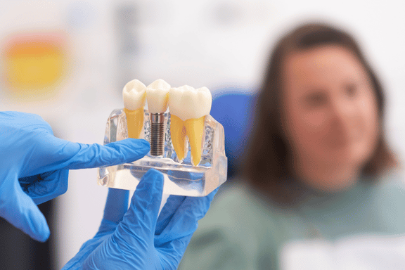 surgeon points to a dental implant model showing patient in chair