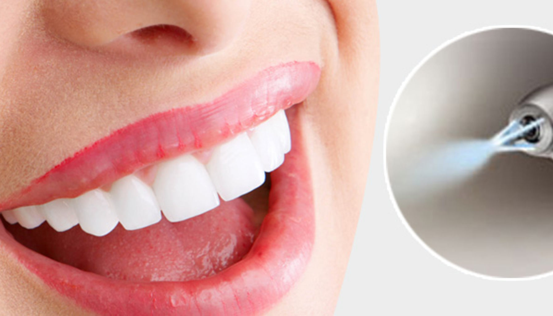 Nærbilde av hvite tenner med et smil, ved siden av tannlegeverktøy som sprayer luft og vann.