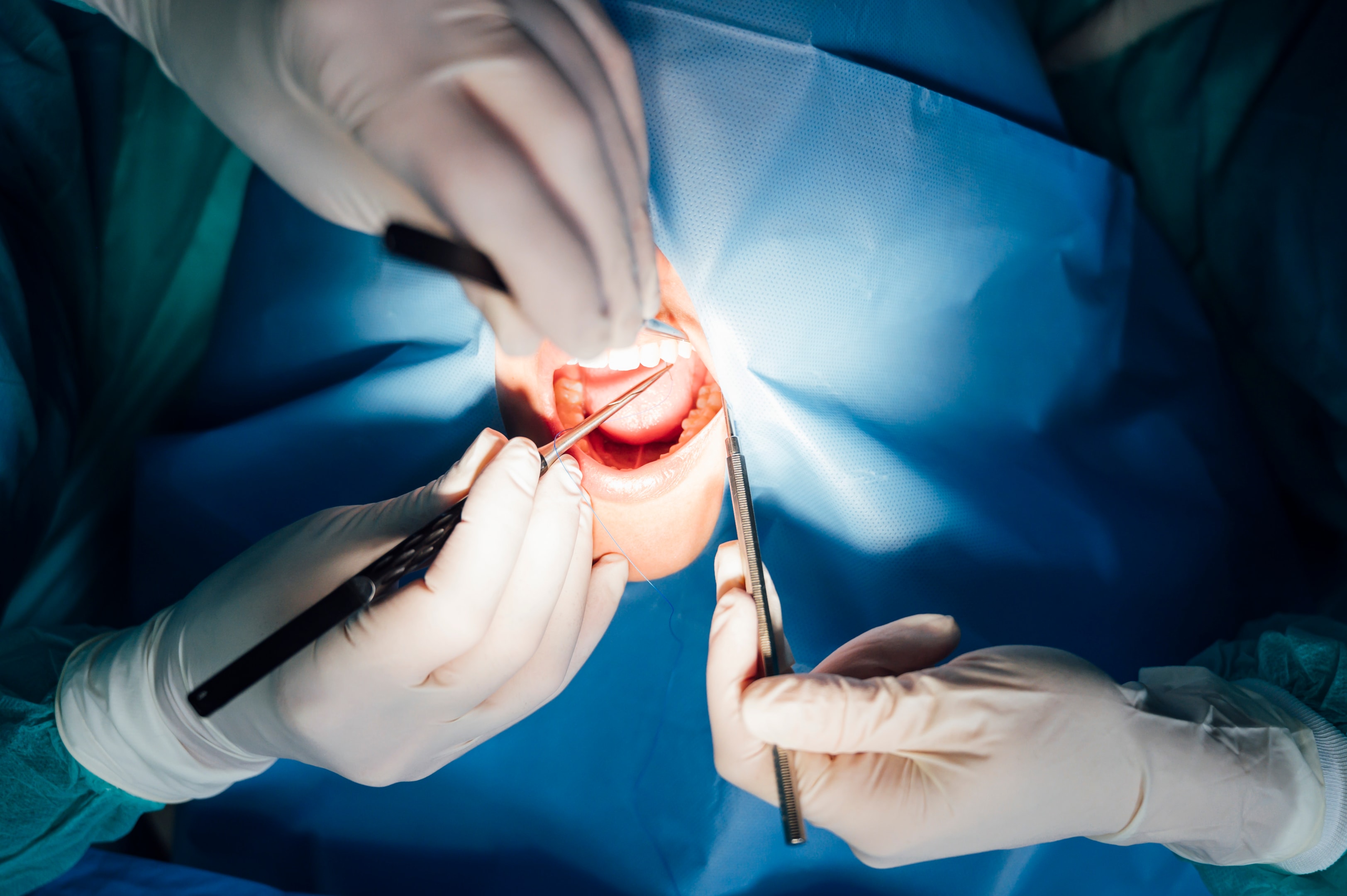 An image of a patient during lower jaw surgery.