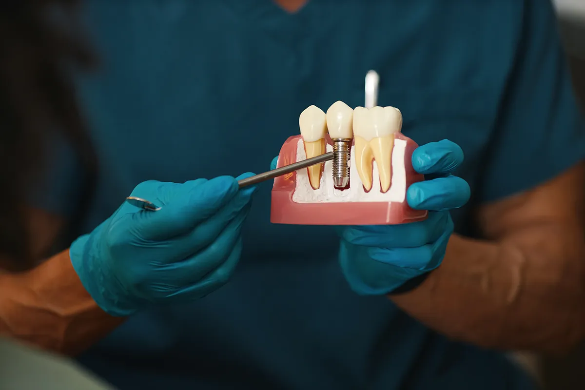 Dental professional demonstrating tooth implant model with educational cross-section.